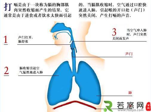 打嗝偏方：打嗝不止怎么办