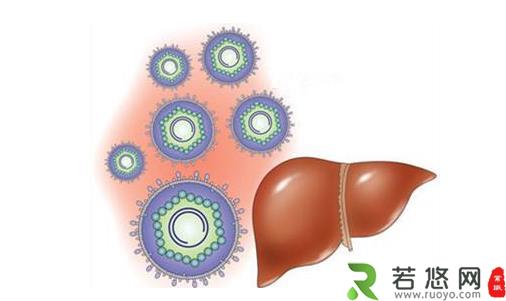 乙肝患者应该如何保健