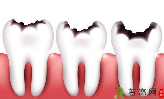 牙齿衰老的症状你知道么？