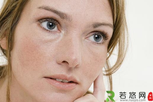 面部色斑知多少 导致色斑的习惯大揭秘