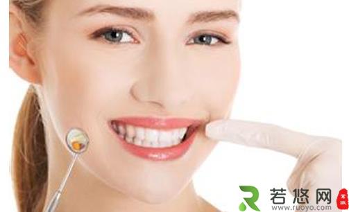 四种方法让你的牙齿变白