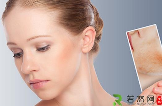 干性皮肤正确使用保湿面膜 干性皮肤日常注意事项